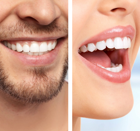 TEETH WHITENING IN AL WARQA