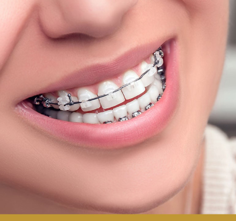 ORTHODONTICS & BRACES IN AL WARQA
