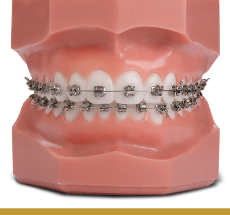 SELF-LIGATING BRACES IN AL WARQA