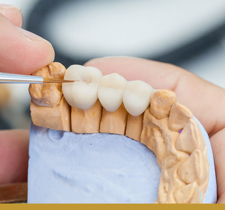 DENTAL BRIDGES & CROWNS IN AL WARQA