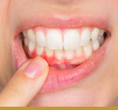 GUM TREATMENT IN AL WARQA