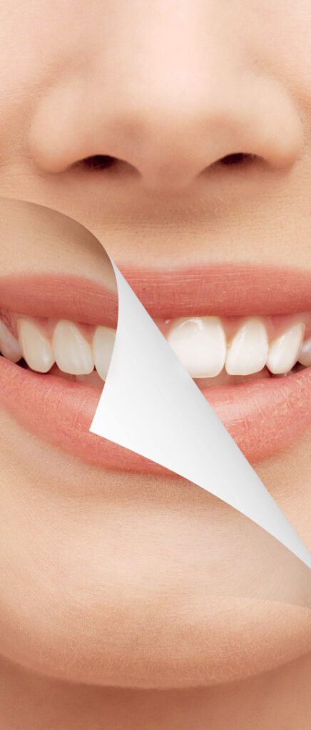 HOLLYWOOD SMILE IN AL WARQA
