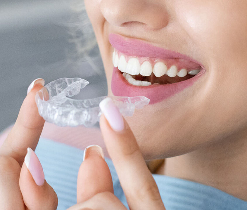 CLEAR ALIGNERS IN AL WARQA