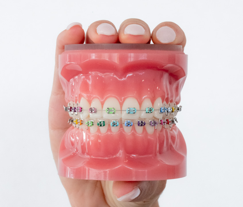 METAL & CERAMIC BRACES IN AL WARQA